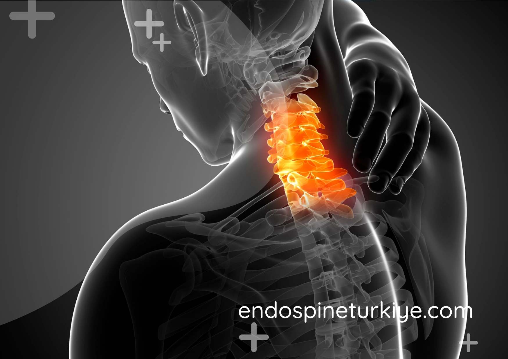 Tam Kapalı Endoskopik Boyun Fıtığı Ameliyatı